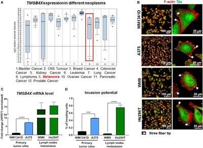 Thymosin β4 Regulates Focal Adhesion Formation in Human Melanoma Cells and Affects Their Migration and Invasion